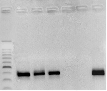 positivo 1 2 3 4 5 6 7 pb 500 400 300 390 pb 200 Figura 39. Electroforesis en gel de agarosa de los productos de la segunda PCR con los cultivos primarios (cebadores HE1/HE3).