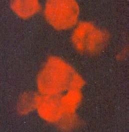 52 M M A Figura 6. Inmunofluorescencia Indirecta. Figura 6 A. Mórulas (M) fluorescentes del control positivo. 400X.