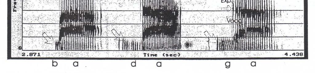 Observar el siguiente espectrograma: FRICATIVAS: En las fricativas hay un estrechamiento en la salida del aire; el aire choca y se produce una turbulencia, un sonido.