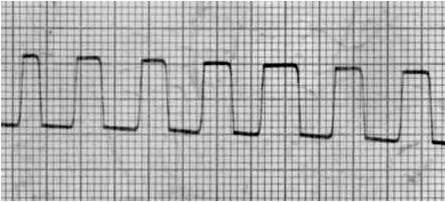 6 01 Derivaciones del plano frontal El corazón se encuentra ubicado en el centro de un campo eléctrico que él mismo genera.
