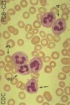 Neutrófilos: Tamaño: aprox. 12 15 u Gránulos citoplasmáticos:.primarios: de tinción azurófila 0.4u, contienen MPO y defen sinas.