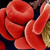Los Eritrocitos, Glóbulos Rojos o Hematíes son las células sanguíneas más numerosas (