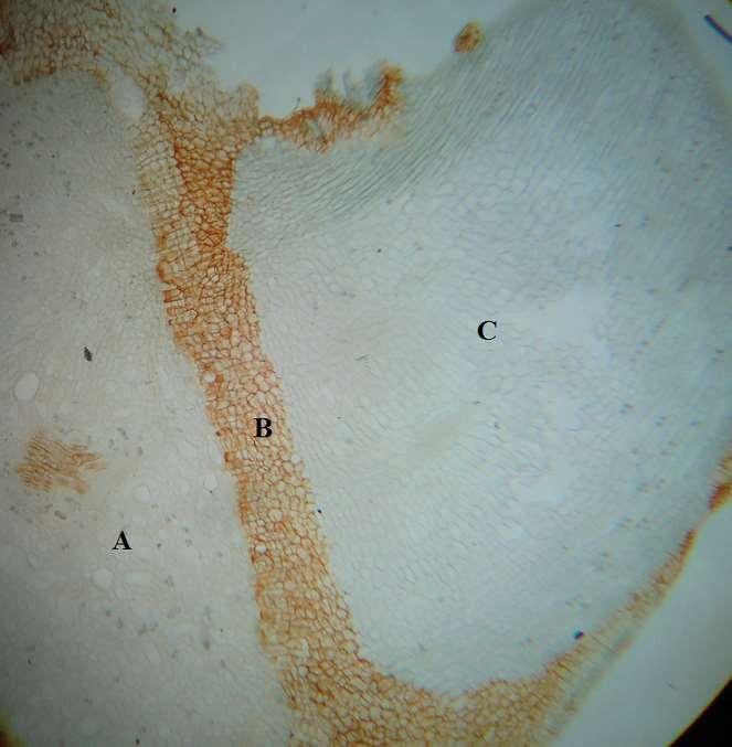 Figura 8.23. Vista al microscopio de un corte longitudinal por la capa de abscisión foliar.
