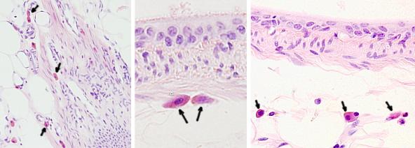 Tipos celulares. Mastocito. 4 Figura 3: Mastocitos teñidos (flechas) más intensamente en el cáliz renal. Figura 4: Esquema del inicio de las reacciones alérgicas (modificado de Bischoff 2007).
