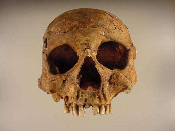 Figura 60. Norma anterior del cráneo correspondiente al Individuo 6.