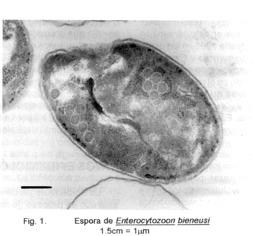 Esporulación: proceso de formación de endosporas Poseen : ADN bacteriano, algo