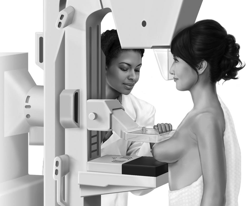 Cómo se hace una mamografía Para prepararse para el examen, deberá desvestirse completamente de la cintura para arriba y ponerse una bata especial.