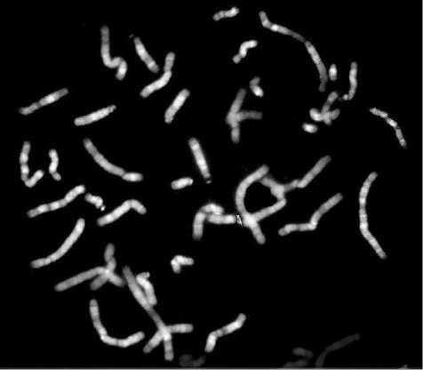 cromosomas de alta resolución (850 bandas).