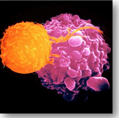 Evasión del tumor a los mecanismos anti-tumorales Modulación de antígenos propios del tumor