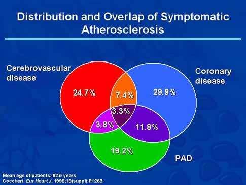 Distribucion y Compromiso de Aterosclerosis