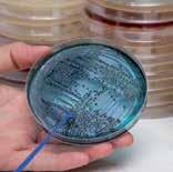 Microbiología Bolsas FitBag con medios de enriquecimiento Con medio deshidratado aptas para solo añadir el agua estéril. Rápido: preparación en 10 minutos.