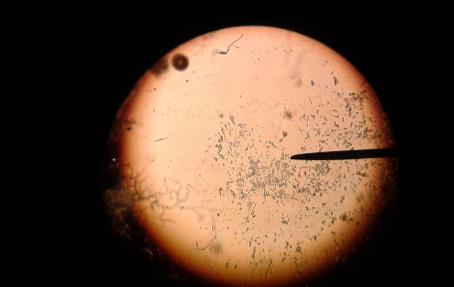 uno microscópico de la tortilla.