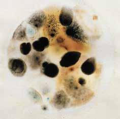 Diferenciación macroscópica Si es necesario diferenciar las colonias de mohos y levaduras en las Placas Petrifilm YM, observe una o más de las características típicas que aquí se muestran: 9 10