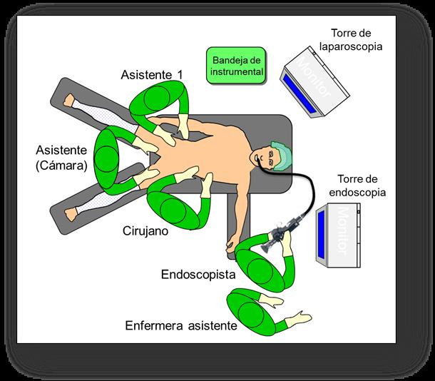 Esta maniobra facilitó la terminación de la CL posterior a la CPRE-EE, ya que la distensión intestinal resultante del aire insuflado durante este procedimiento, limita la disección del lecho