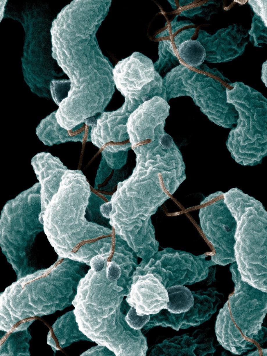 Campylobacter: clasificación y morfología Gram negativo Forma de coma