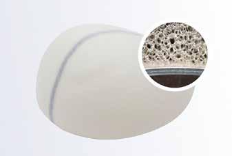 3 nuevos estudios sobre los implantes Microthane en cirugía mamaria En este tipo de implantes, a la silicona se le añade una cubierta de espuma de poliuretano (PU).