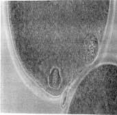 1% de metafase ΙΙ, con los procedentes de folículos medianos (2-2.9 mm de diámetro) un 56.6% de metafase ΙΙ, y con los de folículos grandes (3-6 mm de diámetro) un 74,8% de metafase ΙΙ.