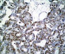 11 fueron los primeros en reportar tumores de células cromófobas en los riñones de animales (ratas) expuestos a nitrosomorfolina. En 1985, Thoenes y cols.