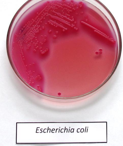 CAPÍTULO 3: RESULTADOS 3.1. Cepas E. coli Se analizaron microbiológicamente los controles positivos, que fueron seis cepas de E. coli patógenas enviadas desde Chile y cuatro E.