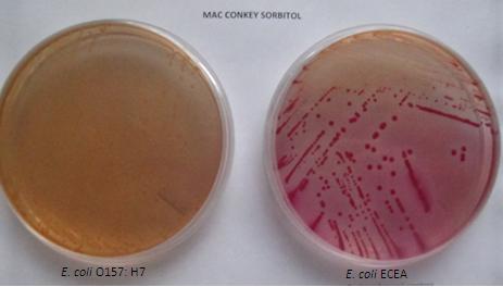 Figura 3.2. E. coli ECEA y E. coli O157:H7 sembradas en Agar Mac Conkey Sorbitol. En la Figura 3.2 se observó que E.