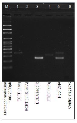 3.4.1. Primer ensayo de la PCR multiplex Se comenzó realizando una PCR convencional multiplex de cada una de las enterovariedades, y se trabajó con una máster mix (Cuadro 2.