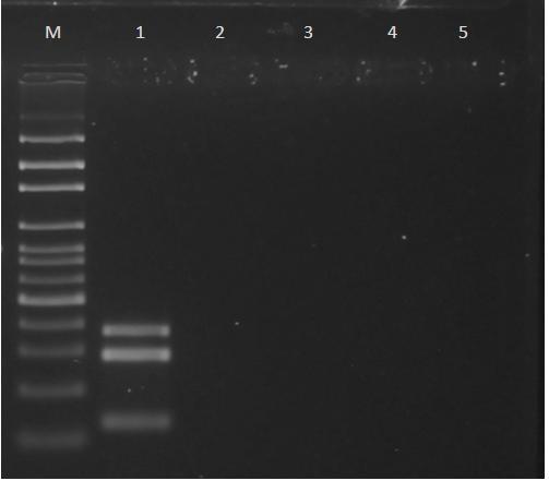 Figura 3. 22. Fotografía de corrida electroforética en gel de agarosa que muestra los productos del ensayo de ensayo de PCR multiplex de las enterovariedades de E. coli en otras bacterias.