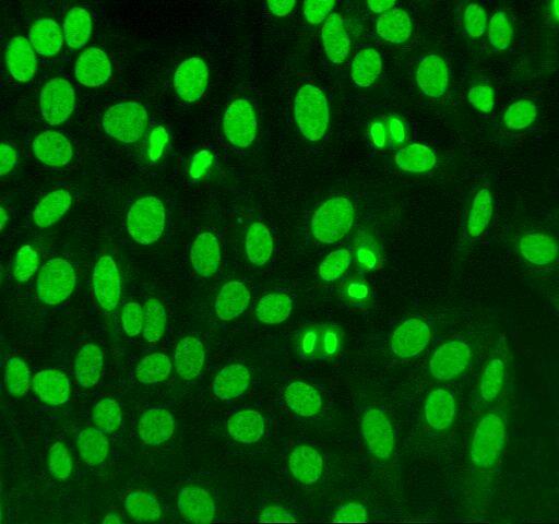 Inmunofluorescencia Anticuerpos
