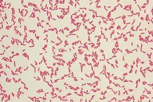 sp. Staphylococcus sp. http://www.
