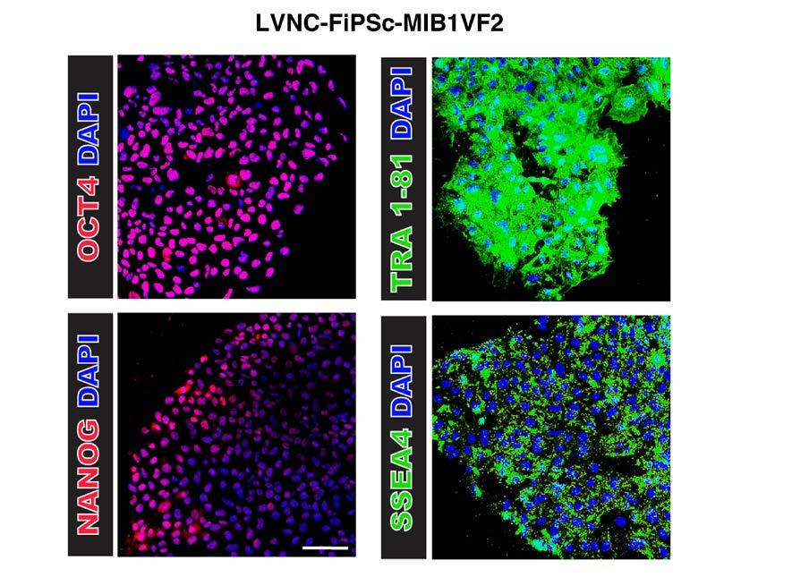 Para confirmar la expresión de los genes de pluripotencia realizamos inmunocitoquímica en la línea celular LVNC-FiPS-MIB1VF2 usando los siguientes anticuerpos primarios: OCT4 (C-10) (SantaCruz,