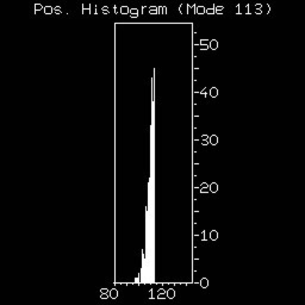 Fig. 29: Histograma del paciente anterior, con pico alto y estrecho, que permite valorar la adecuada