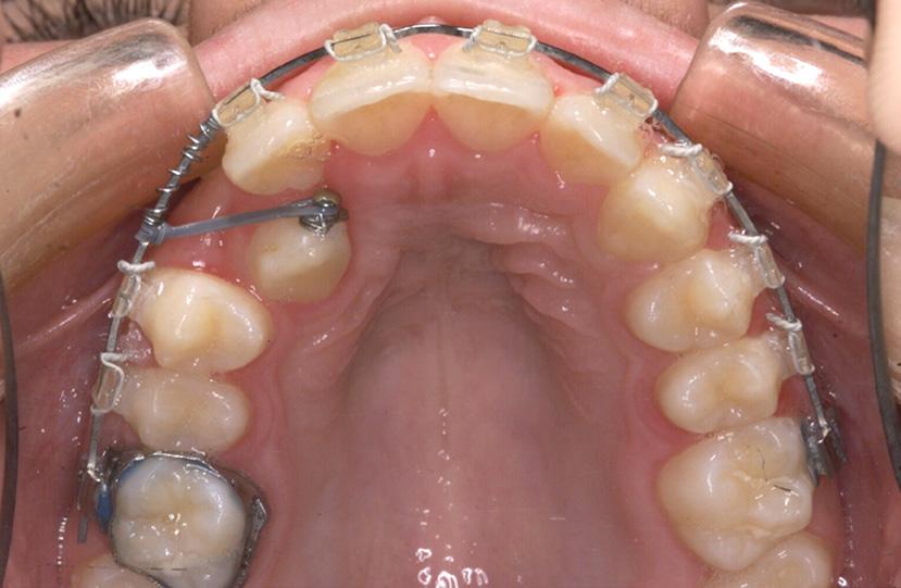 Ortodoncia Multidisciplinaria y Estética Curso 6, DIAGNÓSTICO MULTIDISCIPLINARIO E INTRODUCCIÓN