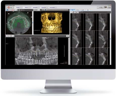 la innovacion en el diagnostico dental Un sistema 3 en 1 con tecnología Cone Beam Sistema que se puede actualizar con el brazo cefalométrico Sensor único para obtener imágenes panorámicas y 3D de