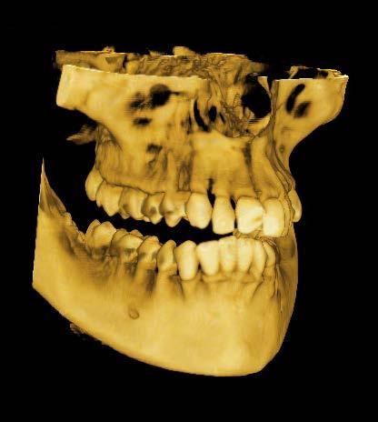 calidad de imagen superior Funciones 3D del software Dental Studio Plus La avanzada tecnología de Rotograph Evo 3D permite visualizar las imágenes en tiempo