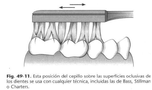 Para realizar un correcto cepillado en las caras oclusales de los dientes se debe colocar el cepillo formando un ángulo recto con respecto al eje longitudinal de los dientes, los extremos de las