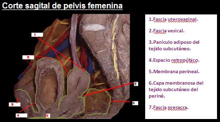 Espacio prevesical o de Retzius Fosa isquiorrectal Bolsa perineal superficial Arteria hipogástrica Espacio de Retzius (prevesical) Ligamento de Henle de la pelvis