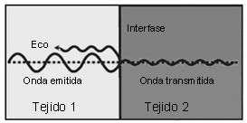 A > Frecuencia< longitud de onda < penetración de la onda > resolución. *TRANSDUCTORES LINEALES 1 MHz = 1.000.