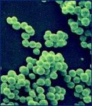 Intoxicación n por Staphylococcus aureus Agente: Staphylococcus aureus (enterotoxina termoestable) Período de incubación: n: 30 minutos (2 4 horas) Características