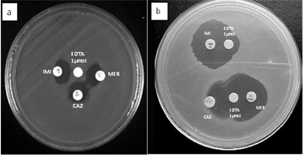 BGNNF y pruebas de sensibilidad 149 Figura 2. Ensayos de detección de MBL a) Detección de MBL usando EDTA 1 µmol en P. aeruginosa productora de VIM-2.