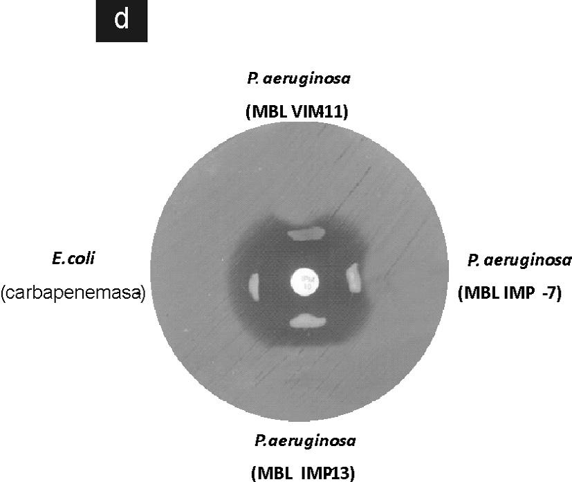 Panel A: se observa desarrollo de la bacteria indicadora alrededor de los discos S y S/Zn, lo que altera los halos de inhibición de IMI (arriba), MER (medio) y