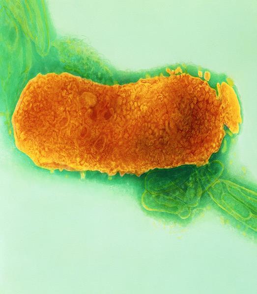 RESULTADOS: Se detectó Fusobacterium necrophorum en el 20,5 % de los pacientes y el 9,4% de los estudiantes asintomáticos. El Strepto.