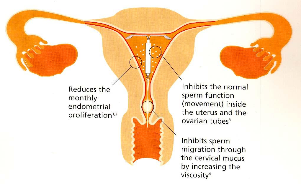 INTRODUCCIÒN MECANISMO DE ACCIÓN Reduce la proliferación endometrial Inhibe la