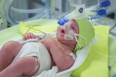 Ventilación para neonatos Volúmenes tidales mínimos de 2 ml Con la opción Neonatal, el HAMILTON-C3 suministra volúmenes tidales de hasta 2 ml como mínimo para conseguir una ventilación con protección