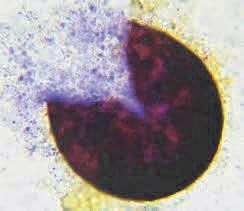 Archiascomycetes Hemiascomycetes Plectomycetes