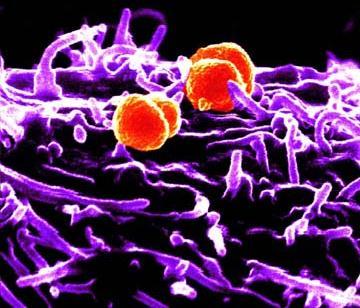 BACTERIAS EXTRACELULARES Mecanismos de RI adaptativa Inmunidad humoral