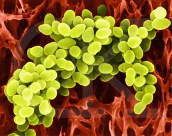 BACTERIAS EXTRACELULARES Mecanismos de evasión Variación antigénica: Ags de superficie de muchas bacterias contenidos en los pili