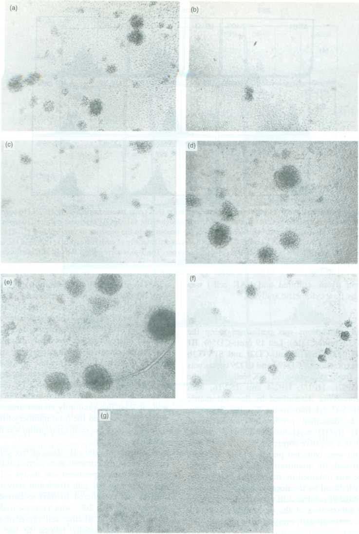C. Macias et al. Figure 3. Lymphocyte-activated killer (LAK) cells (30% aggregation) in the presence of interleukin-2 (IL-2) (10 U/ml) after 4 hr (a).