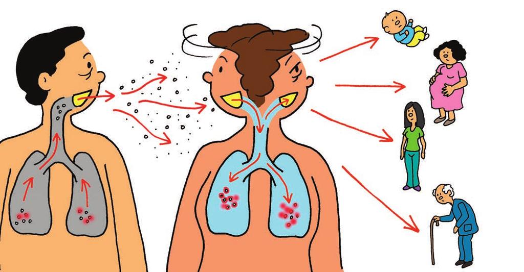 acude al centro de salud más cercano Pasos del contagio 1La tuberculosis se transmite a través del aire, cuando la persona enferma elimina gotitas al toser, estornudar, hablar o cantar.