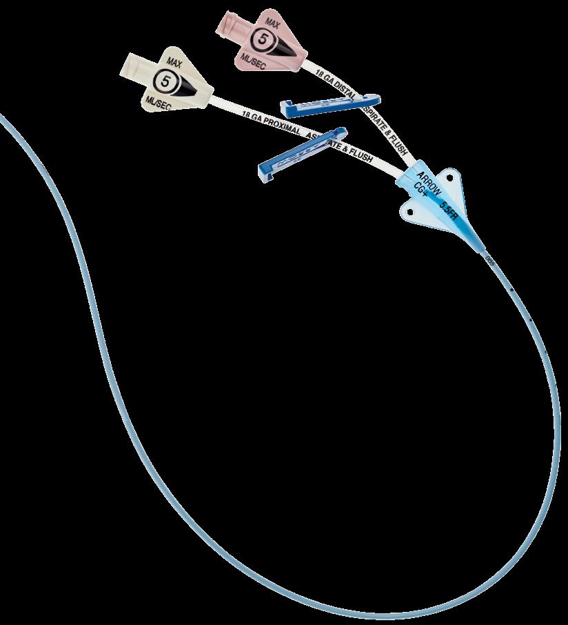 Diseño del catéter sin ensanche Permite mayor flujo sanguíneo alrededor del catéter y minimiza el riesgo de trombosis 4, 5, 6 relacionada con el catéter