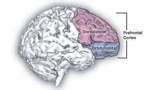 Fibromialgia Disfunción cognitiva: córtex prefrontal y
