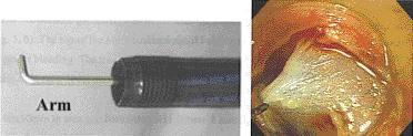 88 Chávez Rossell 3. HOOK KNIFE (Bisturí gancho) La punta del bisturí gancho es de un ángulo recto, de 1 mm de tamaño y puede ser rotado en cualquier dirección.